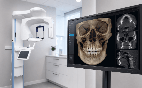 Carestream CS 9300-style scanner beside a monitor displaying a de-identified 3D maxillofacial CBCT study