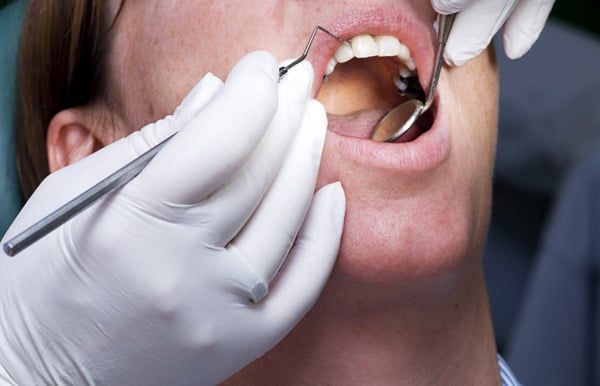 Dentist examining the inside of a patient's mouth